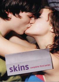 Skins (TV)